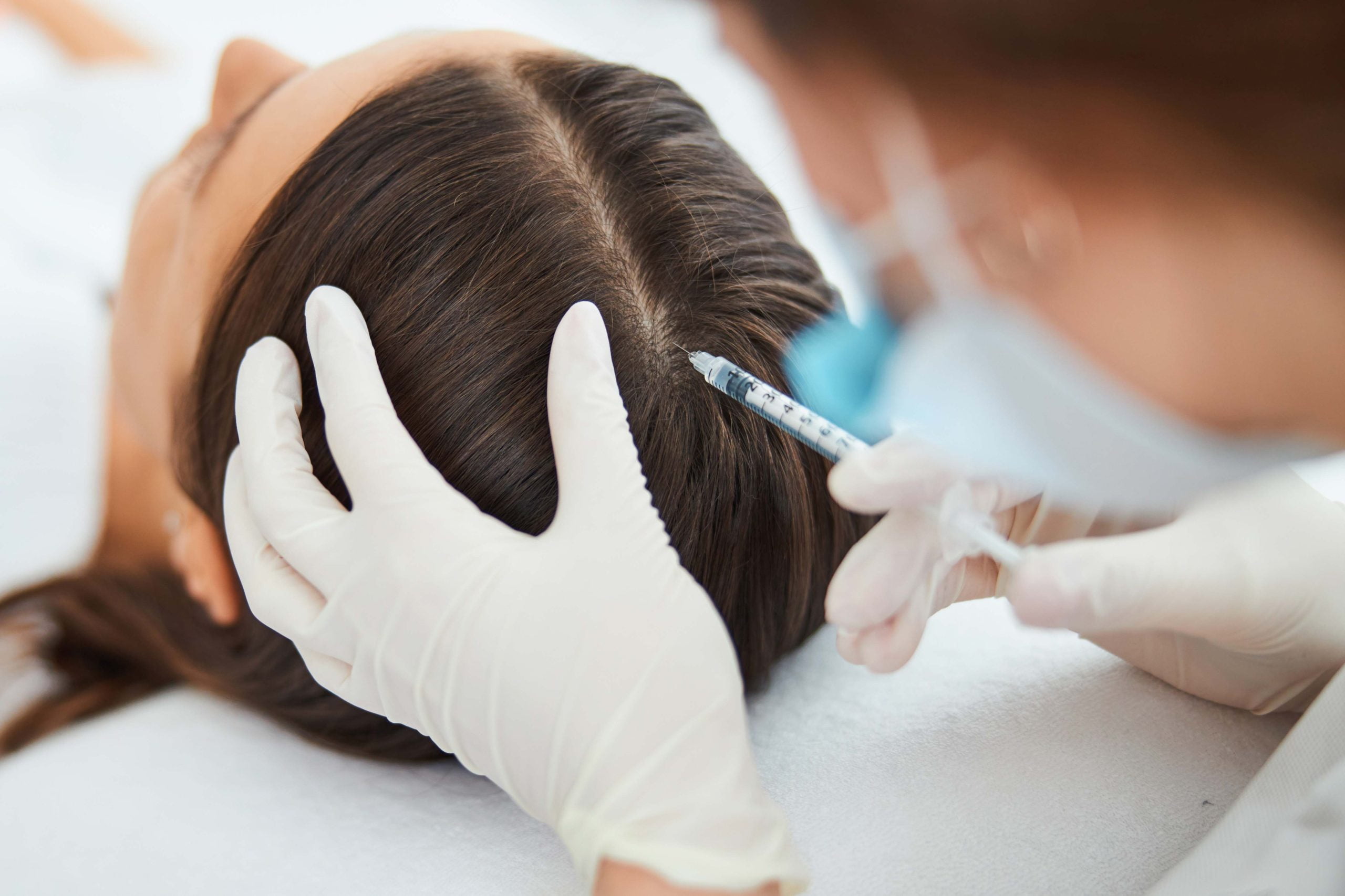 Medicina e Transplante Capilar Mesoterapia