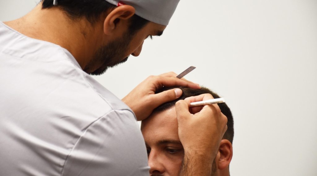 CapilarPro medicina e transplante capilar