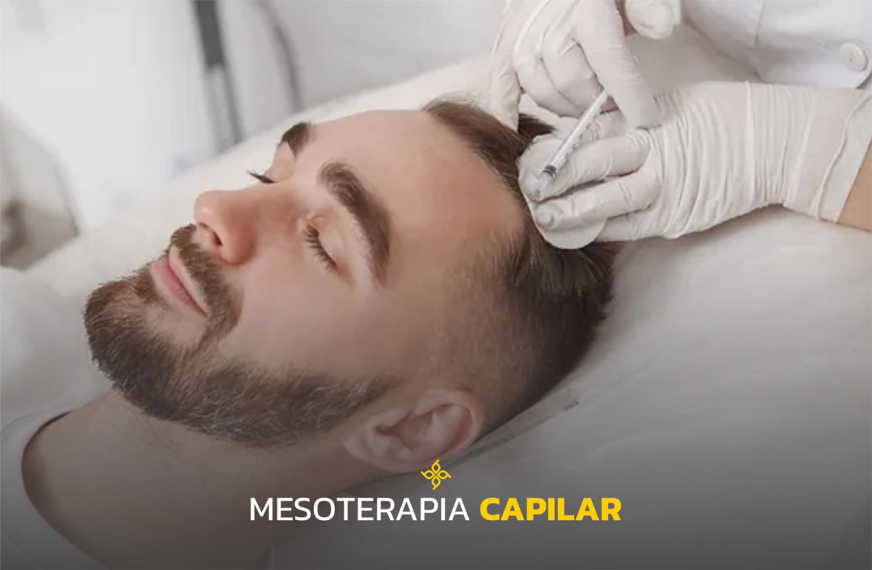 Mesoterapia capilar