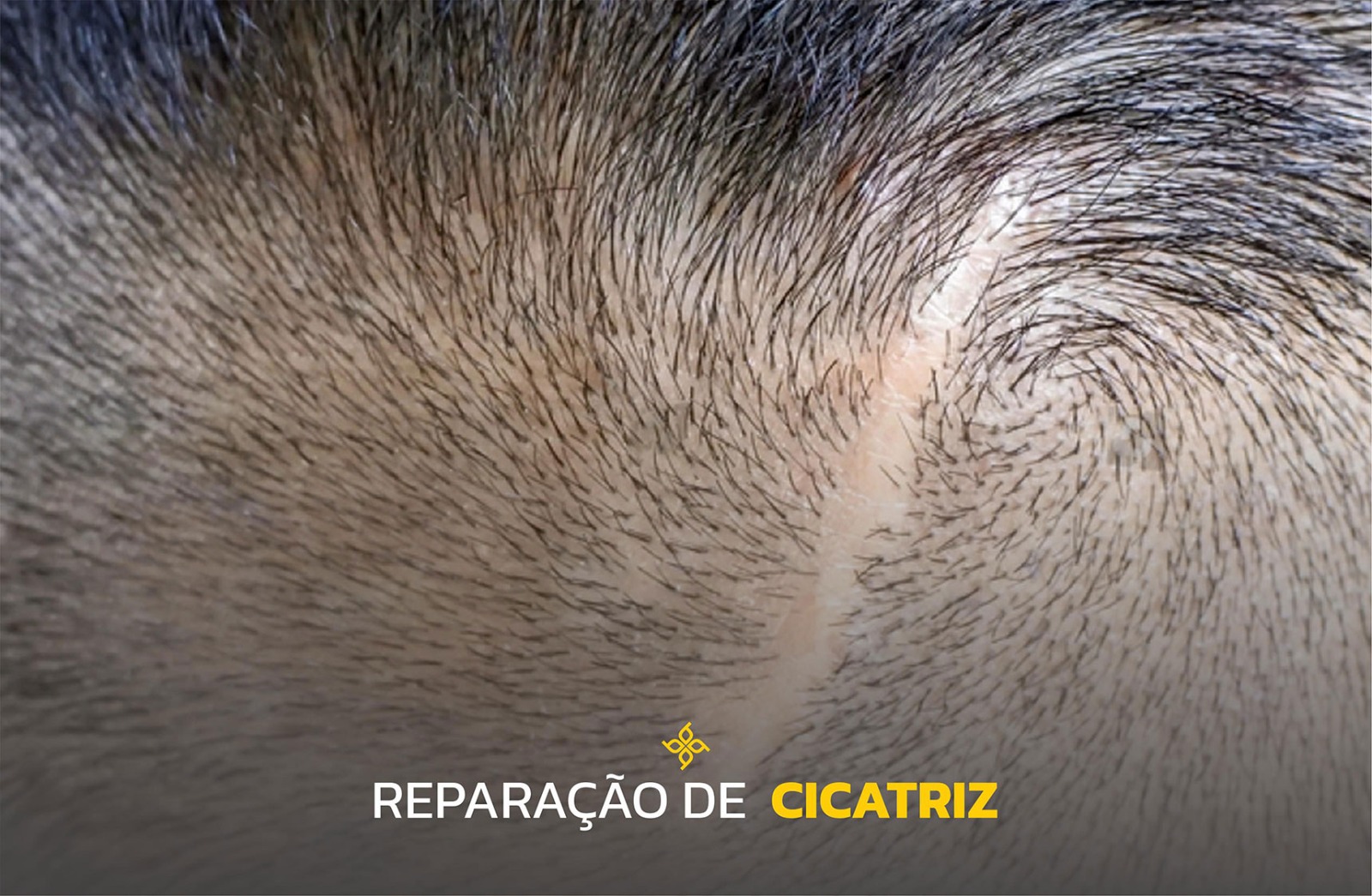 Reparação de cicatriz