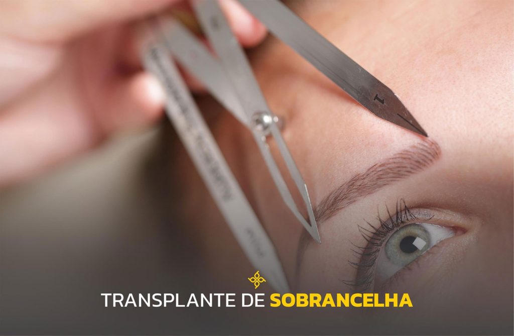 Transplante sobrancelha